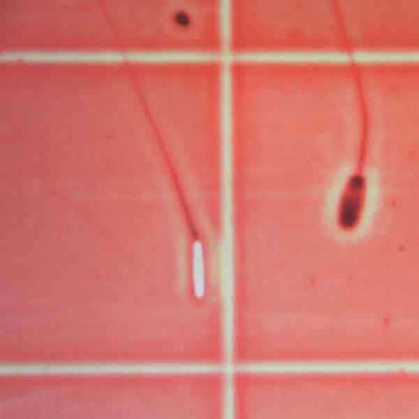 10.025510/Z⠀⠀INTERNATIONAL CASING PRODUCTS, S.L.U.